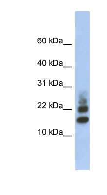 Western Blot: RPS15A Antibody [NBP1-55208]