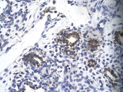 Immunohistochemistry: RPS16 Antibody [NBP1-80025]