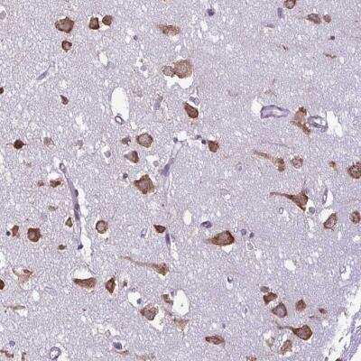 Immunohistochemistry-Paraffin: RPS16 Antibody [NBP2-32384]