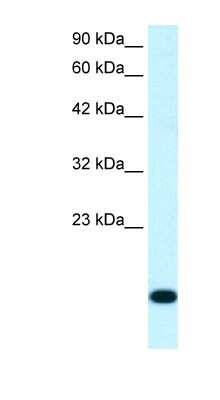 Western Blot: RPS16 Antibody [NBP1-80025]