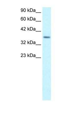 Western Blot: RPS16 Antibody [NBP1-80026]