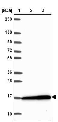 Western Blot: RPS16 Antibody [NBP2-32384]