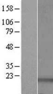 Western Blot: RPS16 Overexpression Lysate [NBL1-15562]