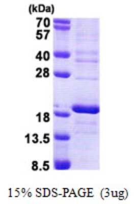 SDS-PAGE: Recombinant Human RPS16 His Protein [NBP2-23430]