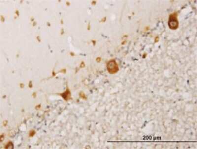 Immunohistochemistry-Paraffin: RPS17 Antibody (2C7) [H00006218-M01]