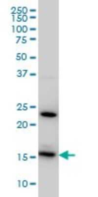 Western Blot: RPS17 Antibody (2C7) [H00006218-M01]