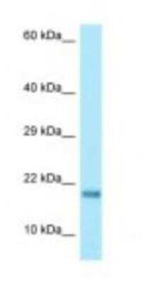 Western Blot: RPS17 Antibody [NBP1-98518]