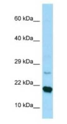 Western Blot: RPS17 Antibody [NBP1-98593]