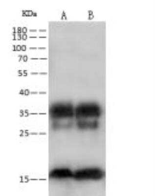 Western Blot: RPS17 Antibody [NBP3-12556]