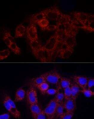 Immunocytochemistry/ Immunofluorescence: RPS18 Antibody - Azide and BSA Free [NBP2-93632]