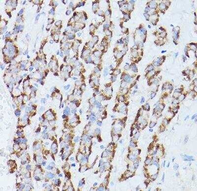 Immunohistochemistry-Paraffin: RPS18 Antibody - Azide and BSA Free [NBP2-93632]