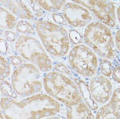 Immunohistochemistry-Paraffin: RPS18 Antibody - Azide and BSA Free [NBP2-93632]