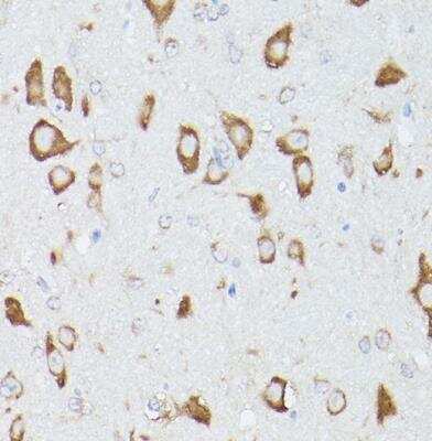 Immunohistochemistry-Paraffin: RPS18 Antibody - Azide and BSA Free [NBP2-93632]