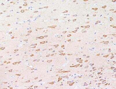 Immunohistochemistry-Paraffin: RPS18 Antibody [NBP3-12554]