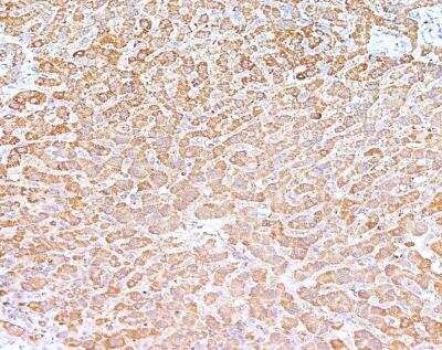 Immunohistochemistry-Paraffin: RPS18 Antibody [NBP3-12554]