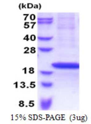 SDS-PAGE: Recombinant Human RPS18 His Protein [NBP2-23431]