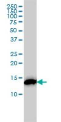 Western Blot: RPS19 Antibody (3C6) [H00006223-M01]