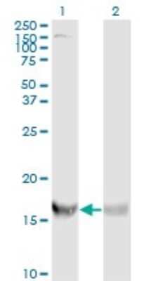 Western Blot: RPS19 Antibody (3C6) [H00006223-M01]