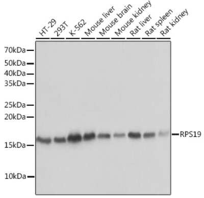 Western Blot: RPS19 Antibody (4V3S7) [NBP3-16244]