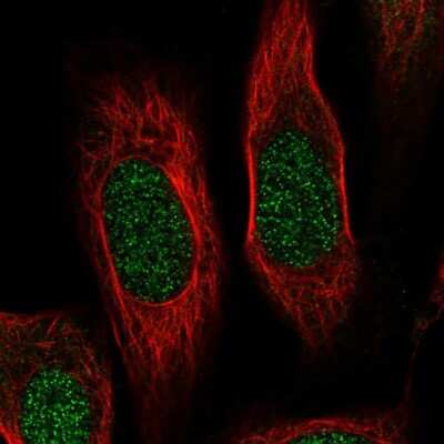 Immunocytochemistry/ Immunofluorescence: RPS19 Antibody [NBP2-68805]