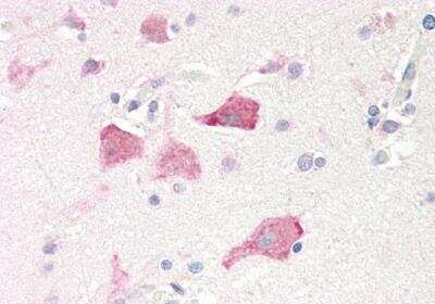 Immunohistochemistry-Paraffin: RPS19 Antibody [NB100-2452]