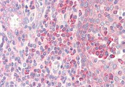 Immunohistochemistry-Paraffin: RPS19 Antibody [NB100-2452]