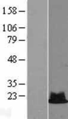 Western Blot: RPS19 Overexpression Lysate [NBL1-15564]