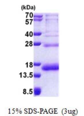 SDS-PAGE: Recombinant Human RPS19 His Protein [NBP2-23432]