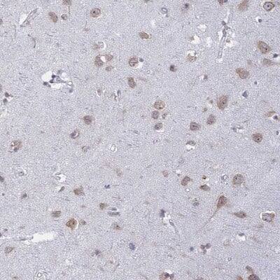 Immunohistochemistry-Paraffin: RPS19BP1 Antibody [NBP1-83617]