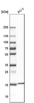 Western Blot: RPS19BP1 Antibody [NBP1-83617]