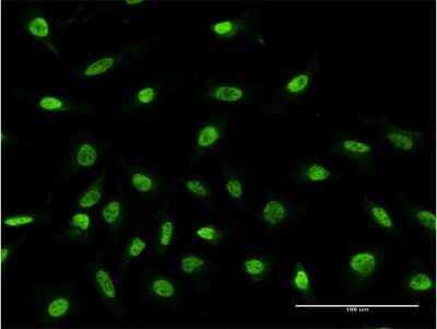 Immunocytochemistry/ Immunofluorescence: RPS2 Antibody (3F5) [H00006187-M05]