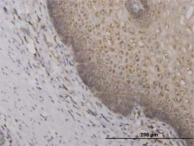 Immunohistochemistry-Paraffin: RPS2 Antibody (3G6) [H00006187-M01]