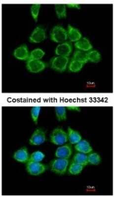 Immunocytochemistry/ Immunofluorescence: RPS2 Antibody [NBP2-20224]