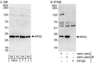 Immunoprecipitation: RPS2 Antibody [NBP2-14852]