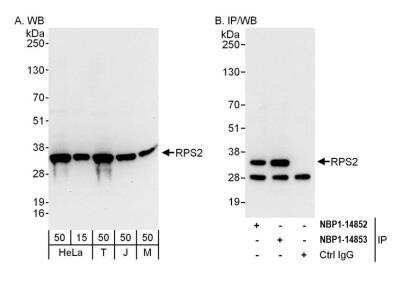 Western Blot: RPS2 Antibody [NBP2-14853]