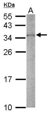 Western Blot: RPS2 Antibody [NBP2-20224]