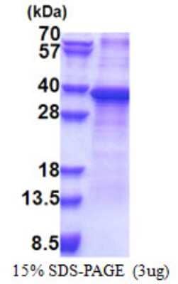 SDS-PAGE: Recombinant Human RPS2 His Protein [NBP2-23433]