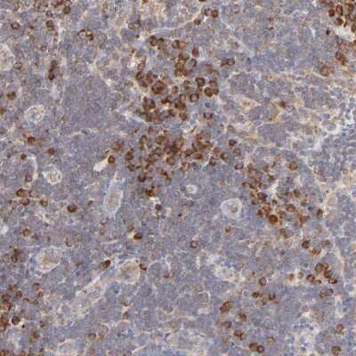 Immunohistochemistry-Paraffin: RPS20 Antibody [NBP1-80804]