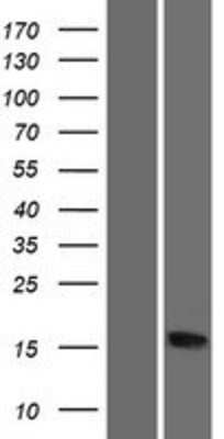 Western Blot: RPS20 Overexpression Lysate [NBP2-10138]