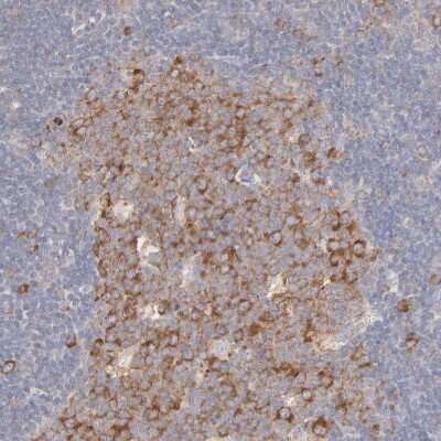 Immunohistochemistry-Paraffin: RPS21 Antibody [NBP1-87100]
