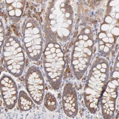 Immunohistochemistry-Paraffin: RPS21 Antibody [NBP1-87100]