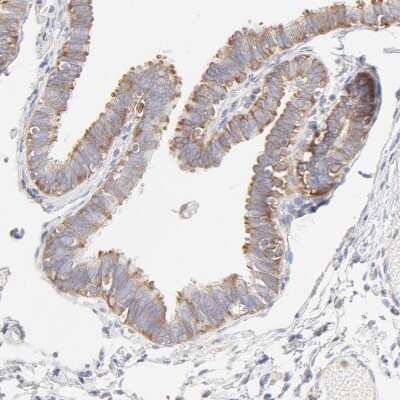 Immunohistochemistry-Paraffin: RPS21 Antibody [NBP1-87100]