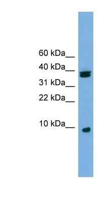 Western Blot: RPS21 Antibody [NBP1-54931]