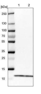Western Blot: RPS21 Antibody [NBP1-87100]
