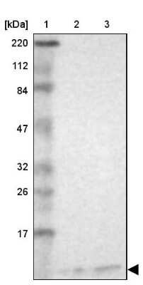 Western Blot: RPS21 Antibody [NBP1-87100]