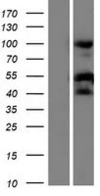 Western Blot: RPS21 Overexpression Lysate [NBP2-08653]