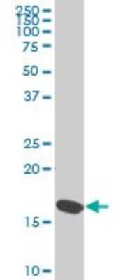 Western Blot: RPS23 Antibody (1E3) [H00006228-M02]