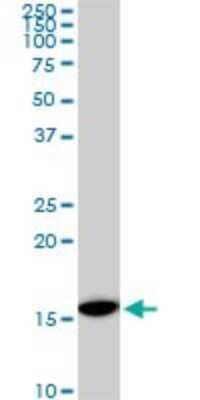 Western Blot: RPS23 Antibody (1E3) [H00006228-M02]