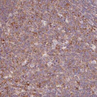 Immunohistochemistry-Paraffin: RPS23 Antibody [NBP2-30412]