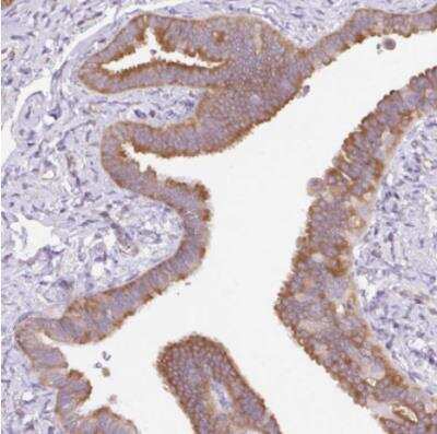 Immunohistochemistry-Paraffin: RPS23 Antibody [NBP2-30412]